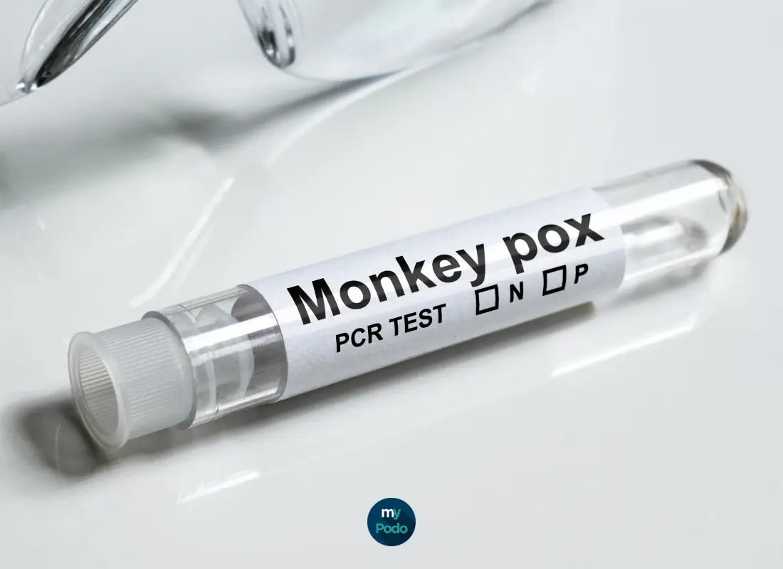 La variole du singe : un défi pour les pédicures-podologues et comment s’en protéger efficacement My Podologie