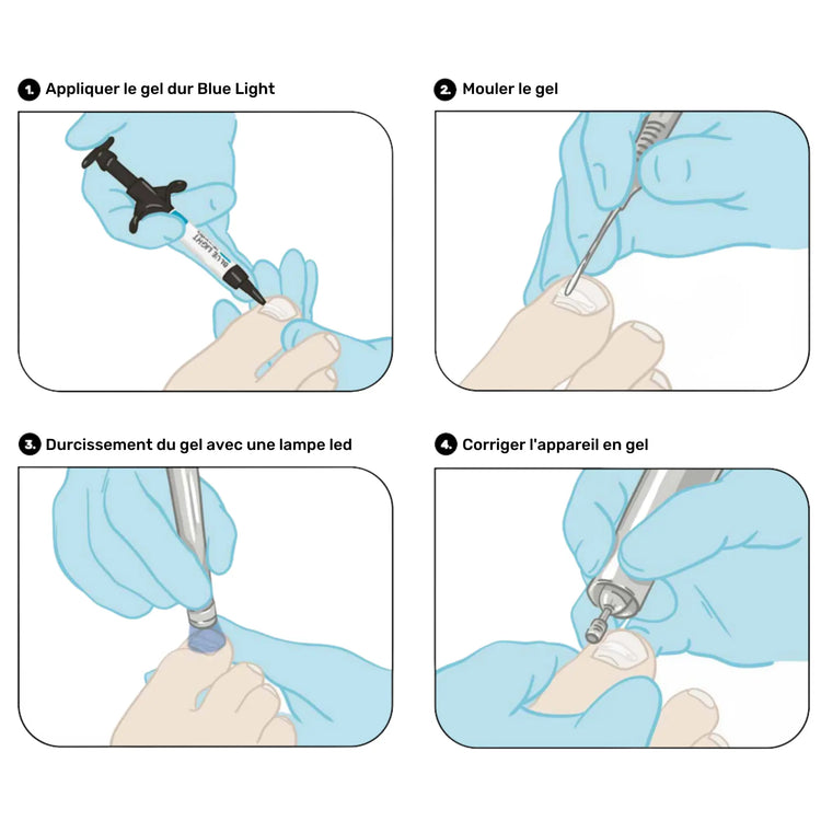 Kit de démarrage professionnel - Blue Light - Ruck - My Podologie