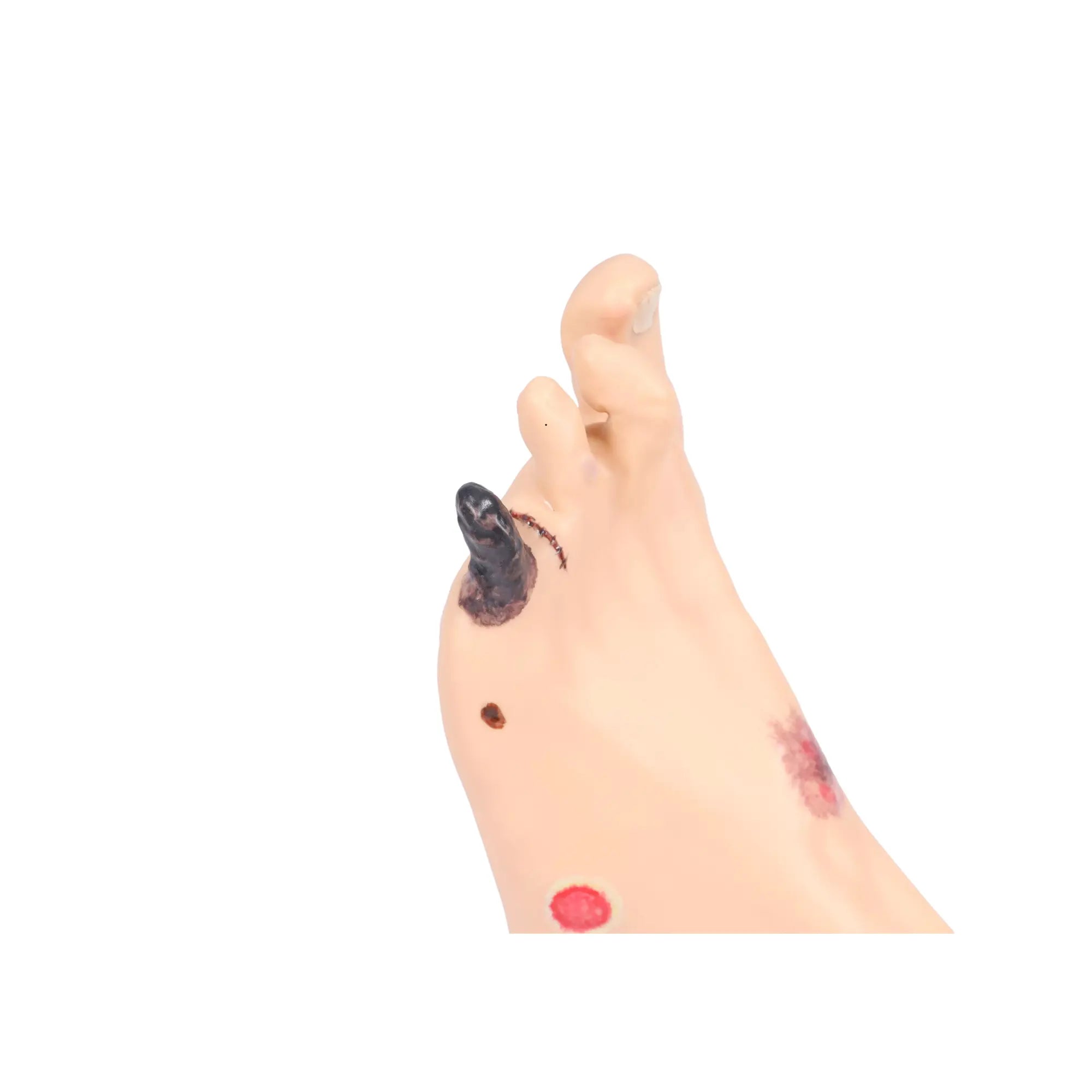 Foot model with wounds - Anatomy and pathology My Podiatry 