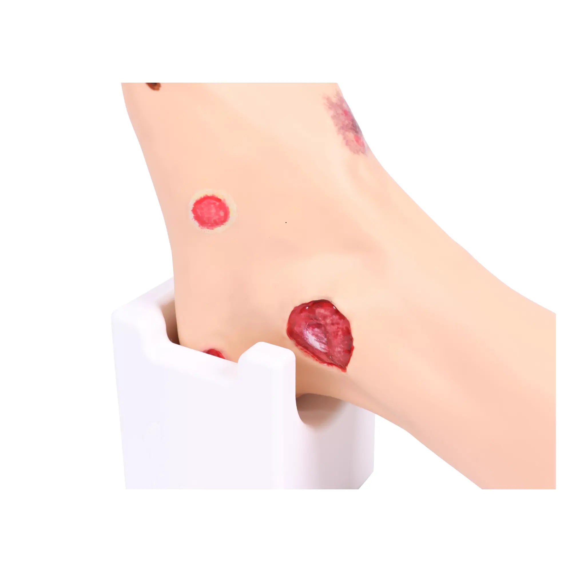 Foot model with wounds - Anatomy and pathology My Podiatry 