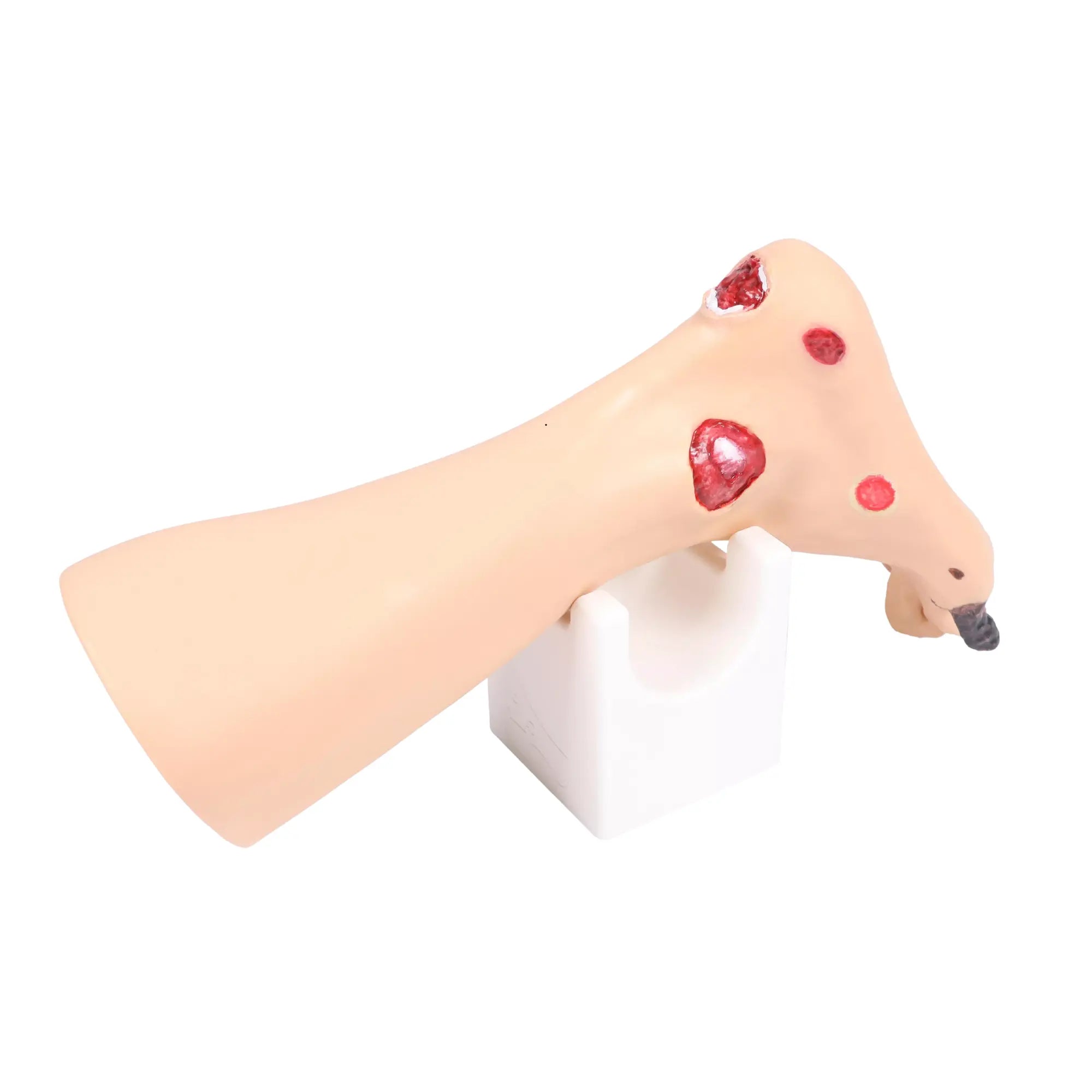 Foot model with wounds - Anatomy and pathology My Podiatry 