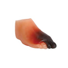 Modelo de pie diabético severo - Anatomía y patología