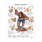 Anatomisch bord - Sportblessures