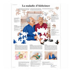 Tavola anatomica - Morbo di Alzheimer - Anatomia e patologia