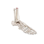 Scheletro del piede con moncone di tibia e perone (fibula), su filo, laterale